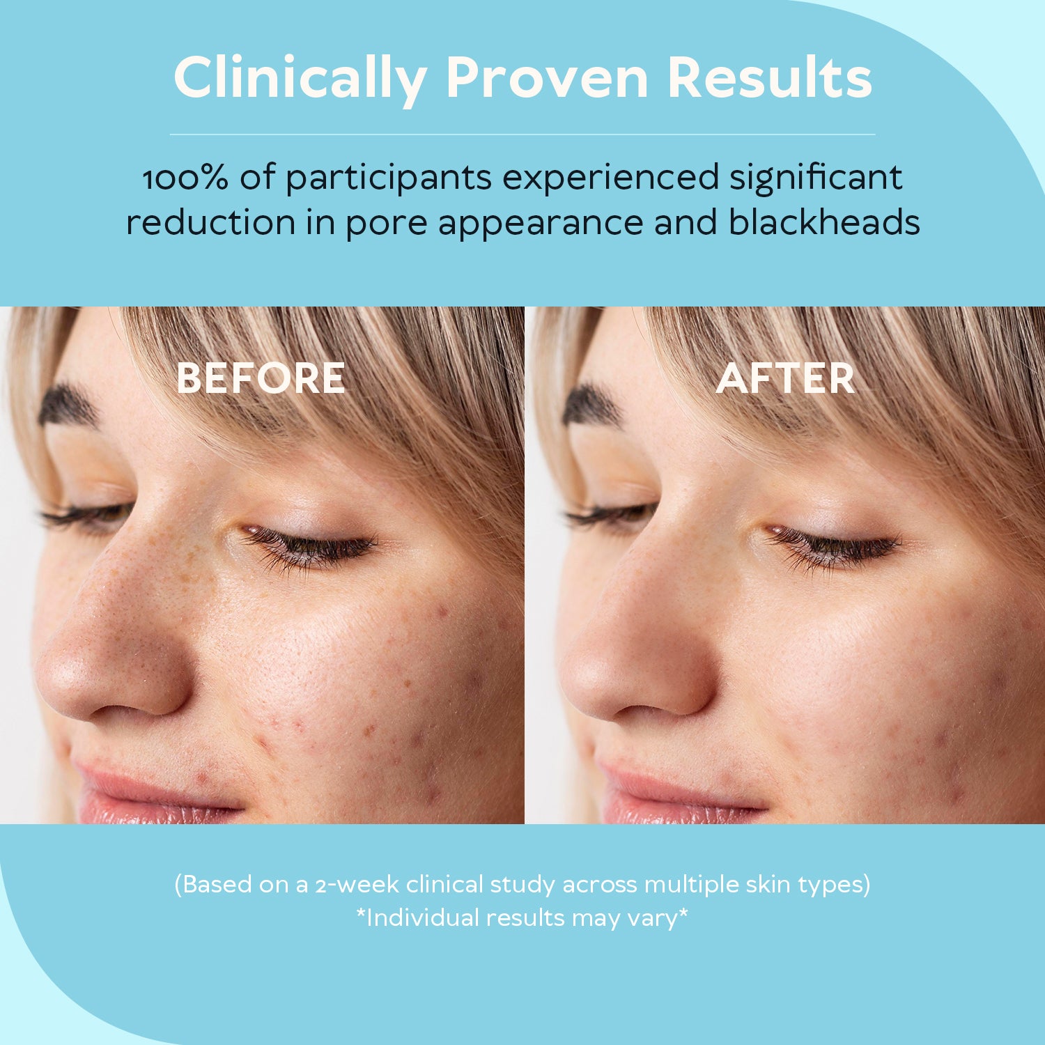 Clinically proven results